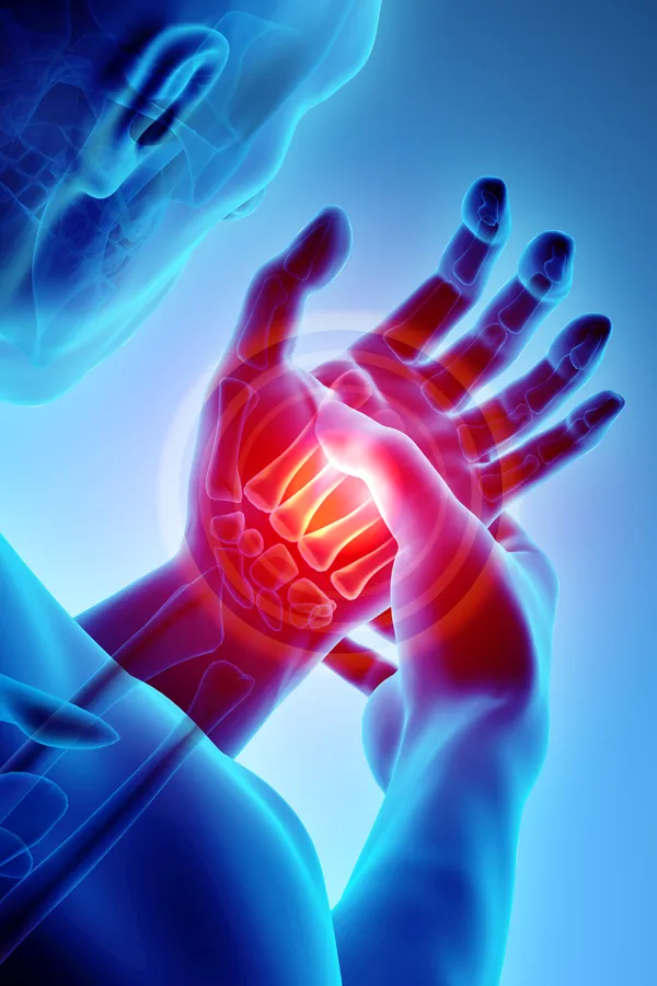 Stem-Cells-for-joint-Pain-Treatment 3D illustration of a man's x-ray holding his hand in pain. Get stem cells for joint pain from Stephen Beyer, DC in Mokena.